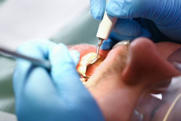 Best Root Canal Emergency Dentist  in Moreland Hills, OH
