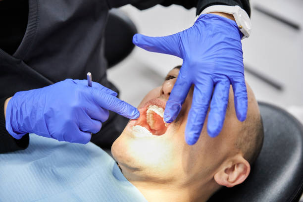 Best Chipped Tooth Repair Near Me  in Moreland Hills, OH
